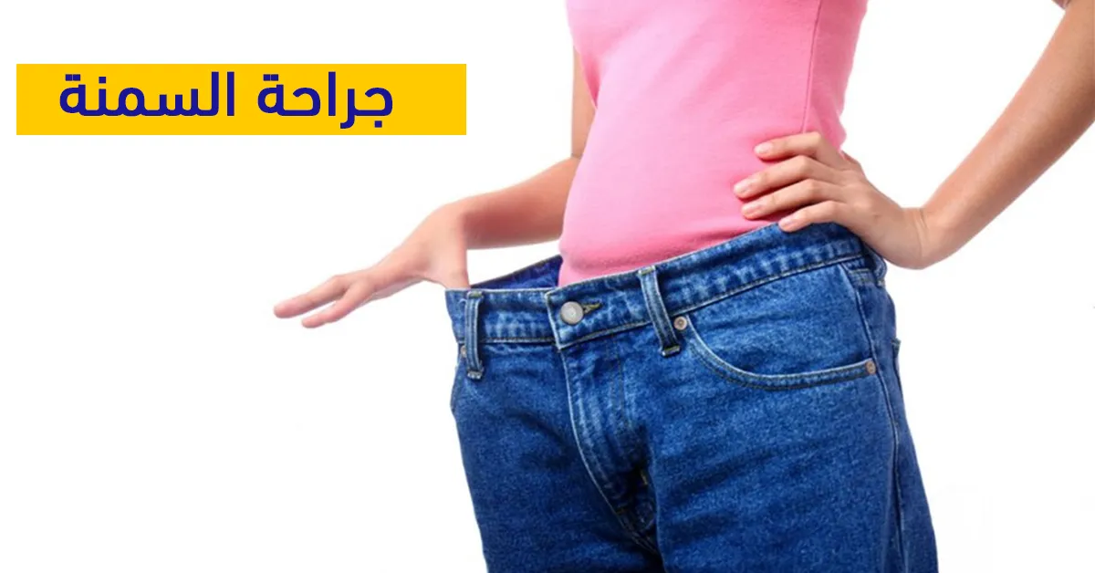 جراحة السمنة